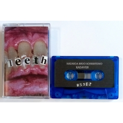 Hazarda Bruo Sonsistemo/Kadaver/Mampos/886VG - Teeth (Fin/Isr/Mal/C...