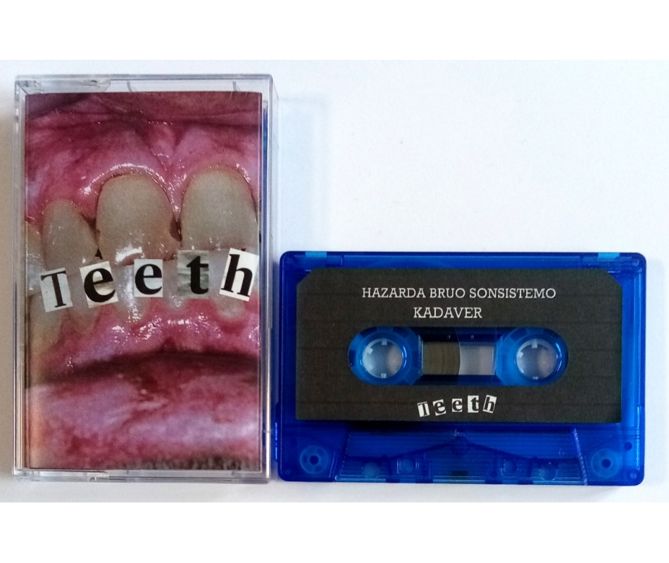Hazarda Bruo Sonsistemo/Kadaver/Mampos/886VG - Teeth (Fin/Isr/Mal/C...