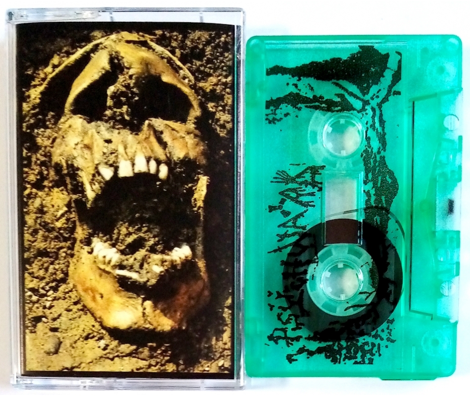 Psychward - Abuse & Terror, Tape Narcolepsia