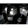 Womb11 - (-) + Poster, Black Edition, LP Dunkelheit Produktionen