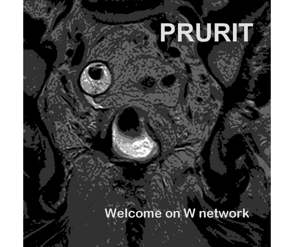 Prurit - Welcome on W network (Bel), CD
