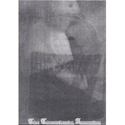 Benflogin - Demo 4, 2006 - The Transcendental Absorption (Bra), CD-R